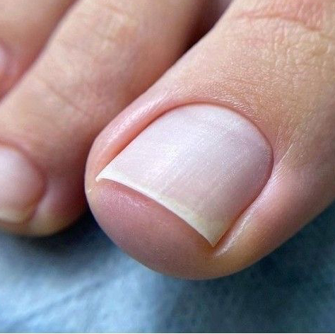 Педикюр без покрытия пальчики