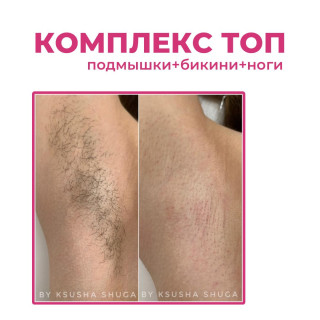 Комплекс ТОП (бикини+подмышки+ноги)