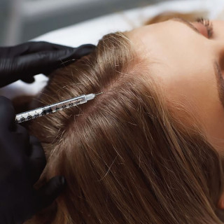 Мезотерапия (кожа головы)