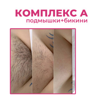 Комплекс А (подмышки+бикини)